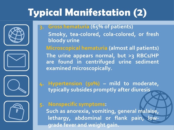 Acute Poststreptococcal Glomerulonephritis