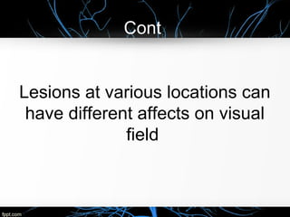 Cont,
Lesions at various locations can
have different affects on visual
field
 