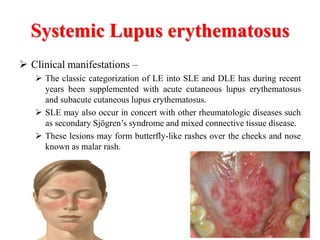 Sle Rash Vs Dle Rash Differential Diagnosis of Lymphadenopathy | PPTX