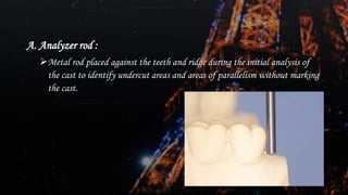 Dental surveying of Removal partial denture | PDF