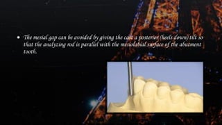 Dental surveying of Removal partial denture | PDF
