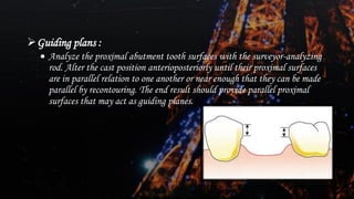 Dental surveying of Removal partial denture | PDF
