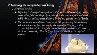 Dental surveying of Removal partial denture | PDF