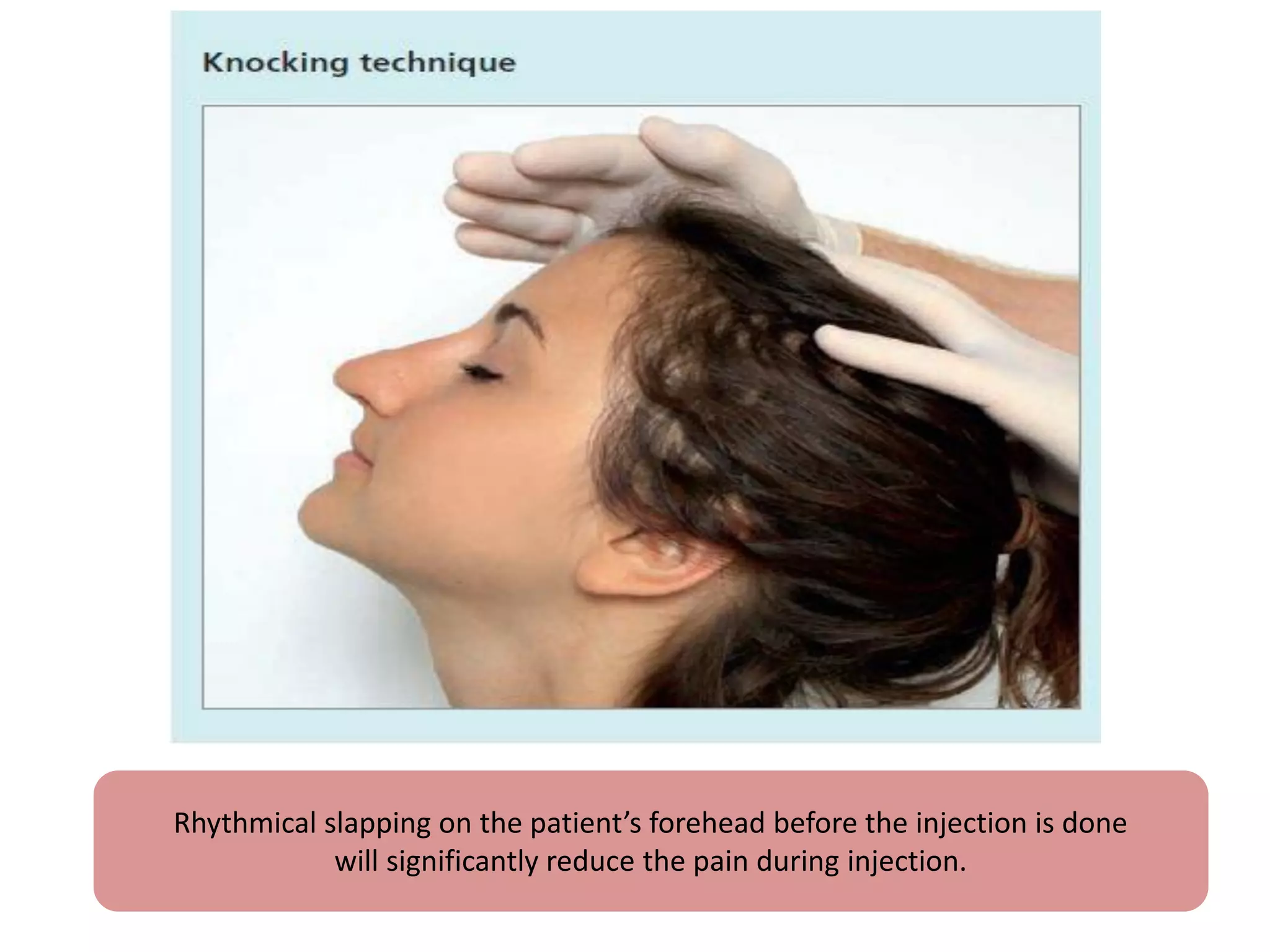 Rhythmical slapping on the patient’s forehead before the injection is done
will significantly reduce the pain during injection.
 