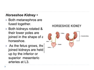 Seminar on genitourinary system | PPTX
