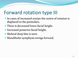 Gradated Rotation GROWTH ROTATION | PPTX