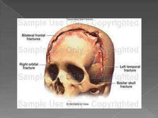 Seminar on head injury and spinal cord injury | PPTX