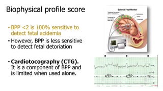 Biophysical profile score
• BPP <2 is 100% sensitive to
detect fetal acidemia
• However, BPP is less sensitive
to detect fetal detoriation
• Cardiotocography (CTG).
It is a component of BPP and
is limited when used alone.
 