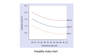 Pulsatility Index chart
 