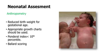 Neonatal Assesment
Anthropometry
• Reduced birth weight for
gestational age.
• Appropriate growth charts
should be used.
• Ponderal index˂ 10th
percentile.
• Ballard scoring
 