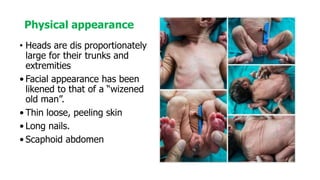 • Heads are dis proportionately
large for their trunks and
extremities
• Facial appearance has been
likened to that of a “wizened
old man”.
• Thin loose, peeling skin
• Long nails.
• Scaphoid abdomen
Physical appearance
 