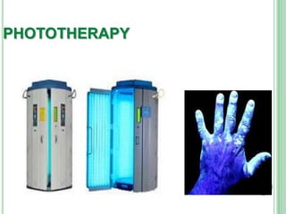 PHOTOTHERAPY
 