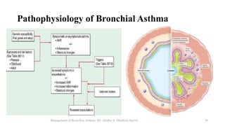 Pathophysiology of Bronchial Asthma
ghyjkv
Management of Bronchial Asthma; BY: Atinkut A. (Medical Intern) 14
 