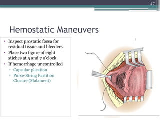 Packing Prostatic Fossa managment of LUTO and simple prostatectomy.pptx