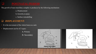  POSTNATAL PERIOD
The growth of naso-maxillary complex is produces by the following mechanism:
a. Displacement
b. Growth at suture
c. Surface remodelling
 DISPLACEMENT:
• It is the movement of the whole bone as a unit.
• Displacement can be of 2 types:
A. Primary
B. Secondary
 