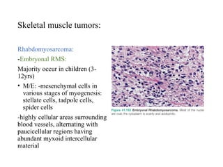 Embryonal Rms seminar on mesenchyml tumors- Rovino.pptx