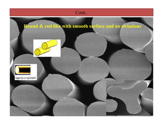Cont..
Round & rod like with smooth surface and no striations
13
 