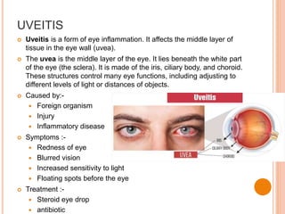 UVEITIS
 Uveitis is a form of eye inflammation. It affects the middle layer of
tissue in the eye wall (uvea).
 The uvea is the middle layer of the eye. It lies beneath the white part
of the eye (the sclera). It is made of the iris, ciliary body, and choroid.
These structures control many eye functions, including adjusting to
different levels of light or distances of objects.
 Caused by:-
 Foreign organism
 Injury
 Inflammatory disease
 Symptoms :-
 Redness of eye
 Blurred vision
 Increased sensitivity to light
 Floating spots before the eye
 Treatment :-
 Steroid eye drop
 antibiotic
 