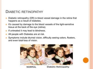 DIABETIC RETINOPATHY
 Diabetic retinopathy (DR) is blood vessel damage in the retina that
happens as a result of diabetes.
 It's caused by damage to the blood vessels of the light-sensitive
tissue at the back of the eye (retina).
 If untreated it may lead to blindness.
 All people with Diabetes are at risk.
 Symptoms include blurred vision, difficulty seeing colors, floaters,
and even total loss of vision.
 