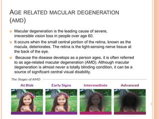 AGE RELATED MACULAR DEGENERATION
(AMD)
 Macular degeneration is the leading cause of severe,
irreversible vision loss in people over age 60.
 It occurs when the small central portion of the retina, known as the
macula, deteriorates. The retina is the light-sensing nerve tissue at
the back of the eye.
 Because the disease develops as a person ages, it is often referred
to as age-related macular degeneration (AMD). Although macular
degeneration is almost never a totally blinding condition, it can be a
source of significant central visual disability.
 