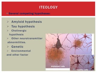 Seminar on pharmacotherapy of alzheimer’s disease | PPTX