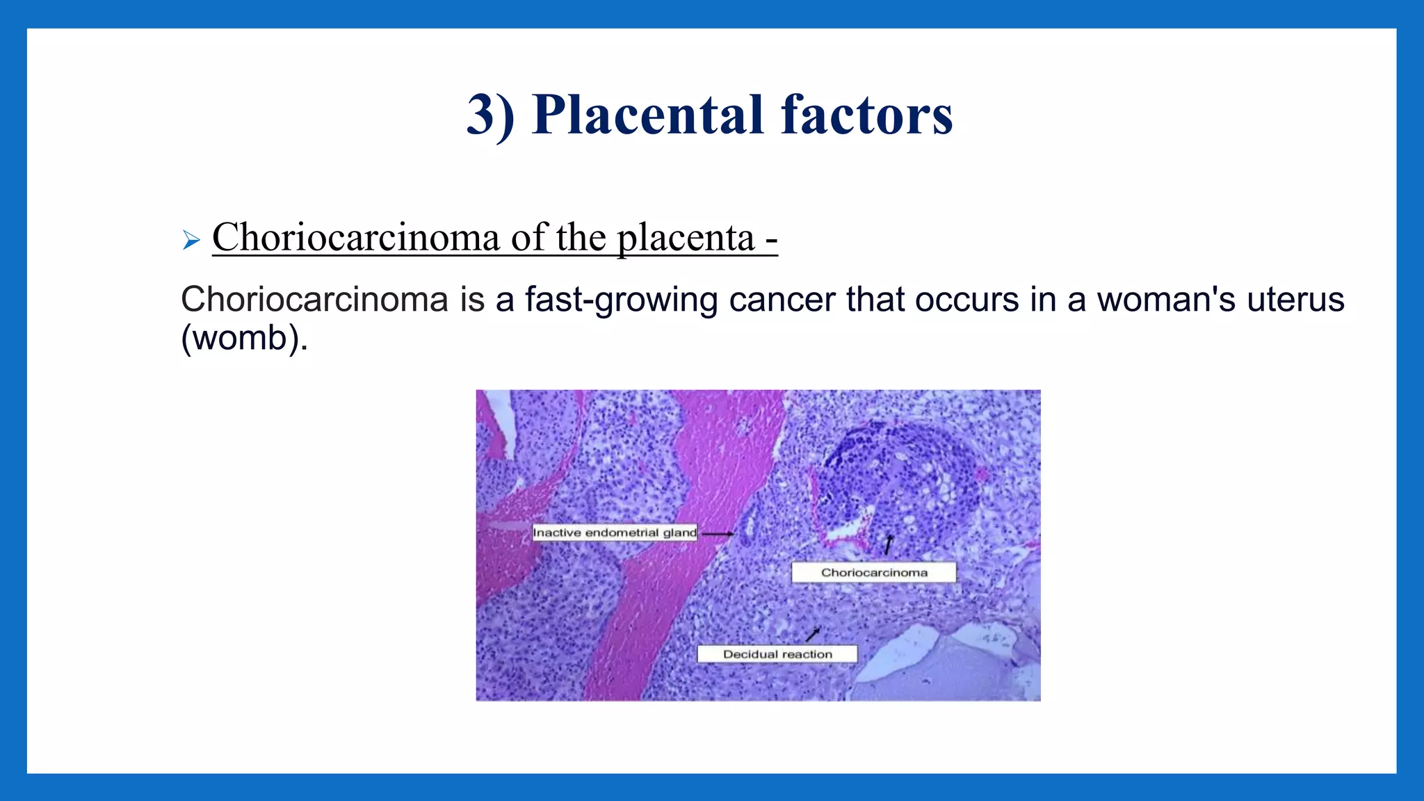3) Placental factors
 Choriocarcinoma of the placenta -
Choriocarcinoma is a fast-growing cancer that occurs in a woman's uterus
(womb).
 