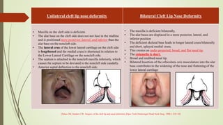seminar on rhinoplasty.pptx
