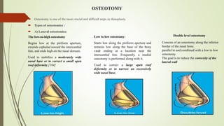 seminar on rhinoplasty.pptx