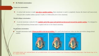 seminar on rhinoplasty.pptx