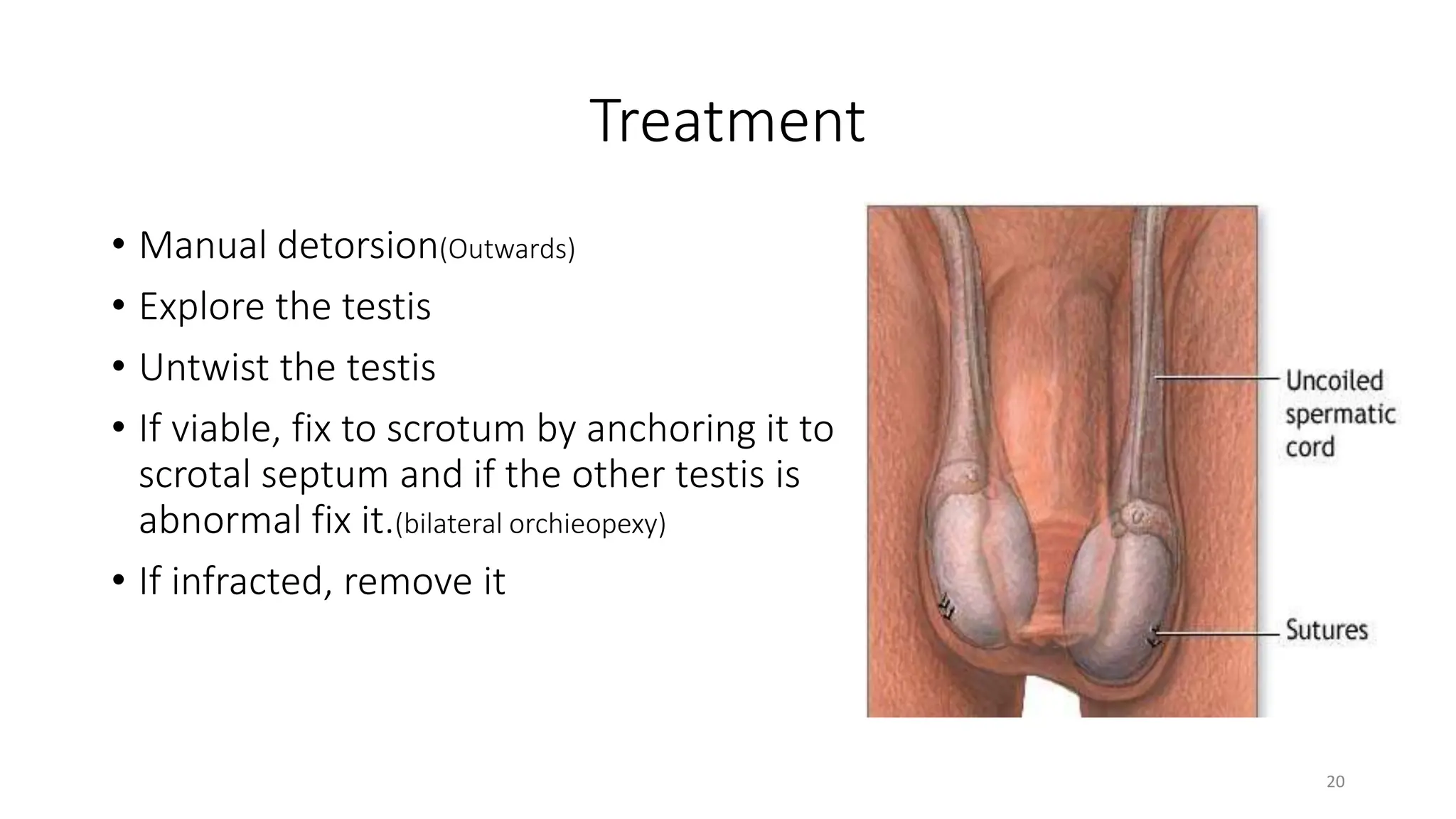 Scrotal and Testicular Swelling pptx Infertility Reproductive Health