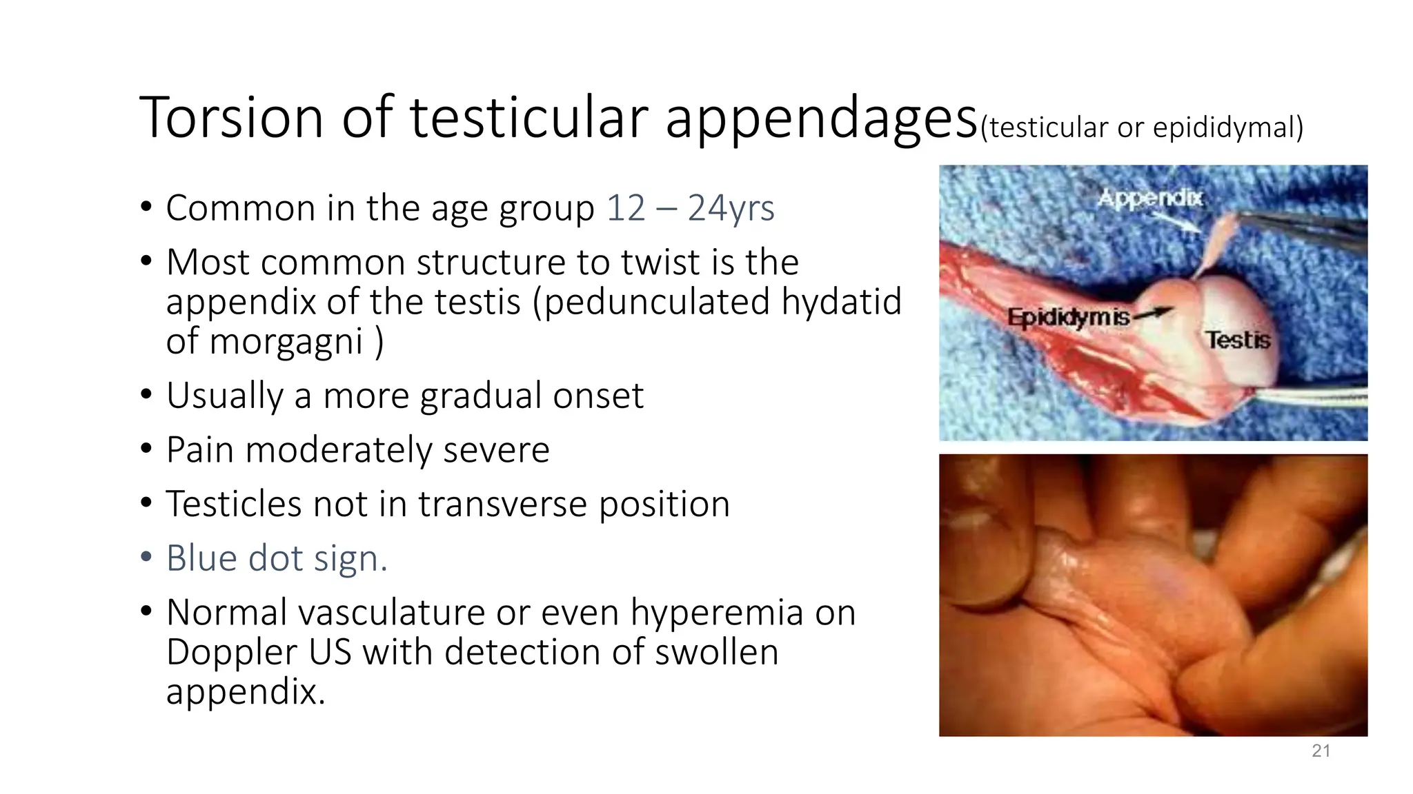 Scrotal and Testicular Swelling pptx