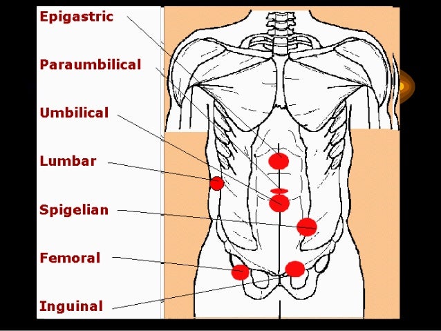 Seminar on scrotal swelling