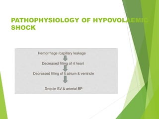 MANAGEMENT OF SHOCK | PPTX