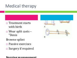 Medical therapy
 Treatment starts
with birth
 Wear split casts –
“Denis
Browne splint
 Passive exercises
 Surgery if required
 