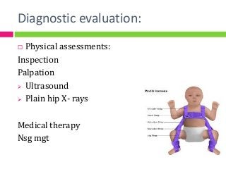Diagnostic evaluation:
 Physical assessments:
Inspection
Palpation
 Ultrasound
 Plain hip X- rays
Medical therapy
Nsg mgt
 