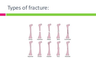 Types of fracture:
 