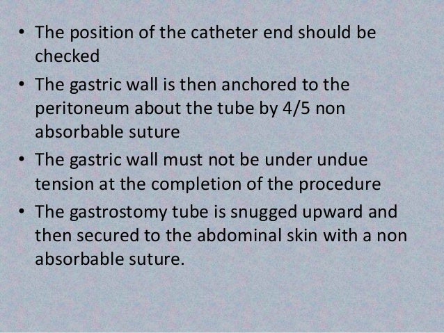 Seminar On Stamm Janeway Pe Gastrostomy