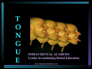T
O
N
G
U
E
INDIAN DENTAL ACADEMY
Leader in continuing Dental Education
www.indiandentalacademy.com
 
