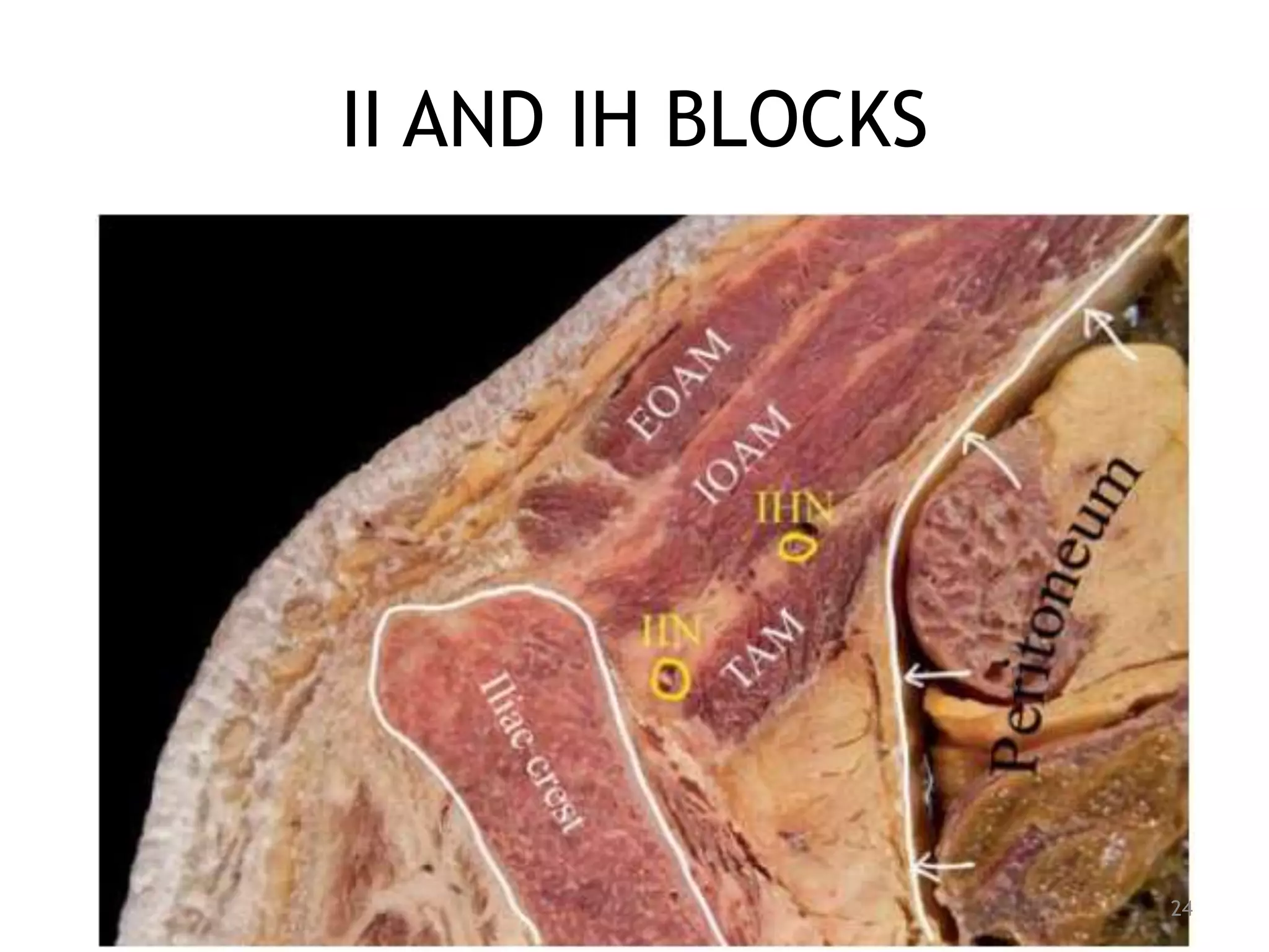 II AND IH BLOCKS
24
 