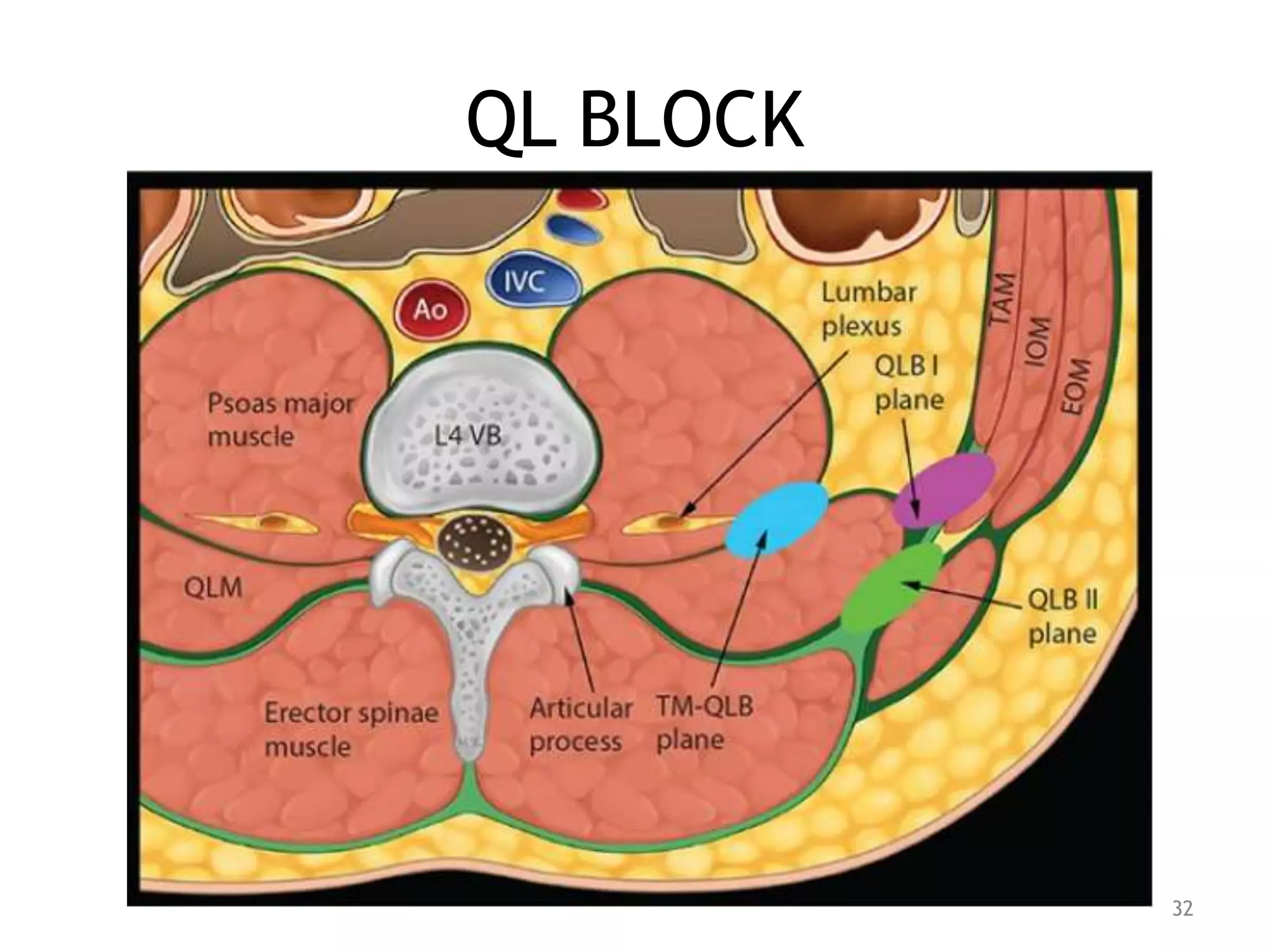 QL BLOCK
32
 