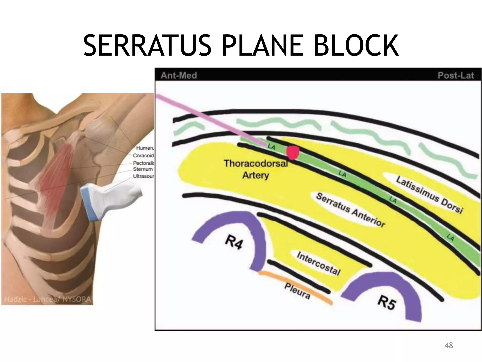SERRATUS PLANE BLOCK
48
 