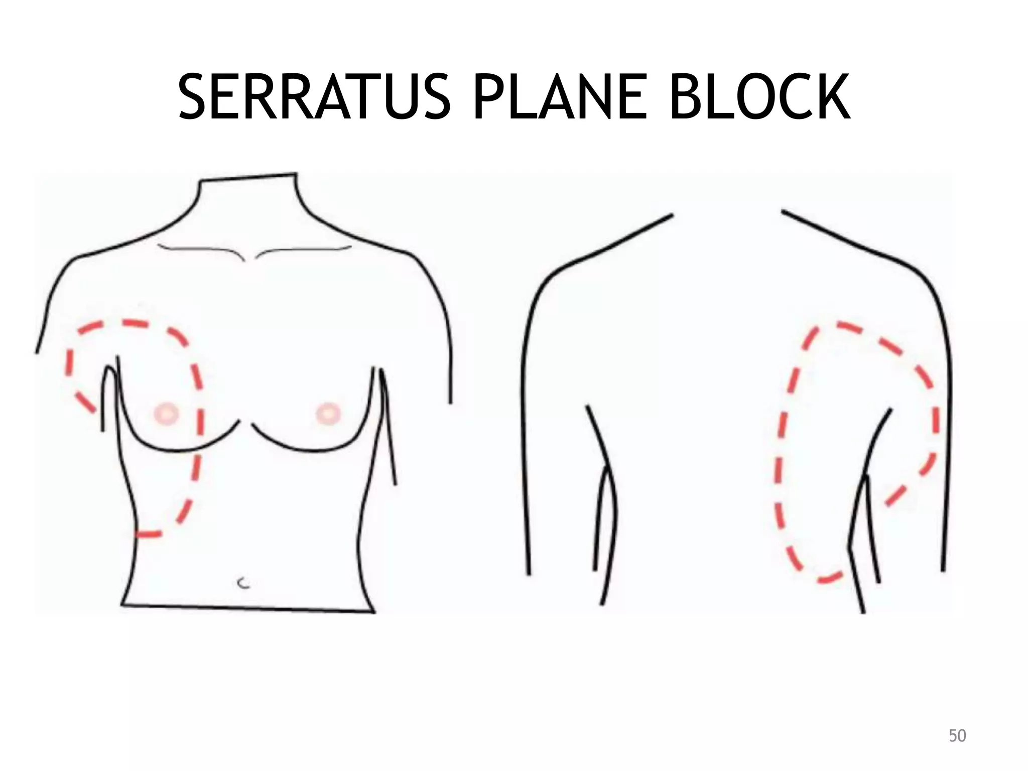 SERRATUS PLANE BLOCK
50
 