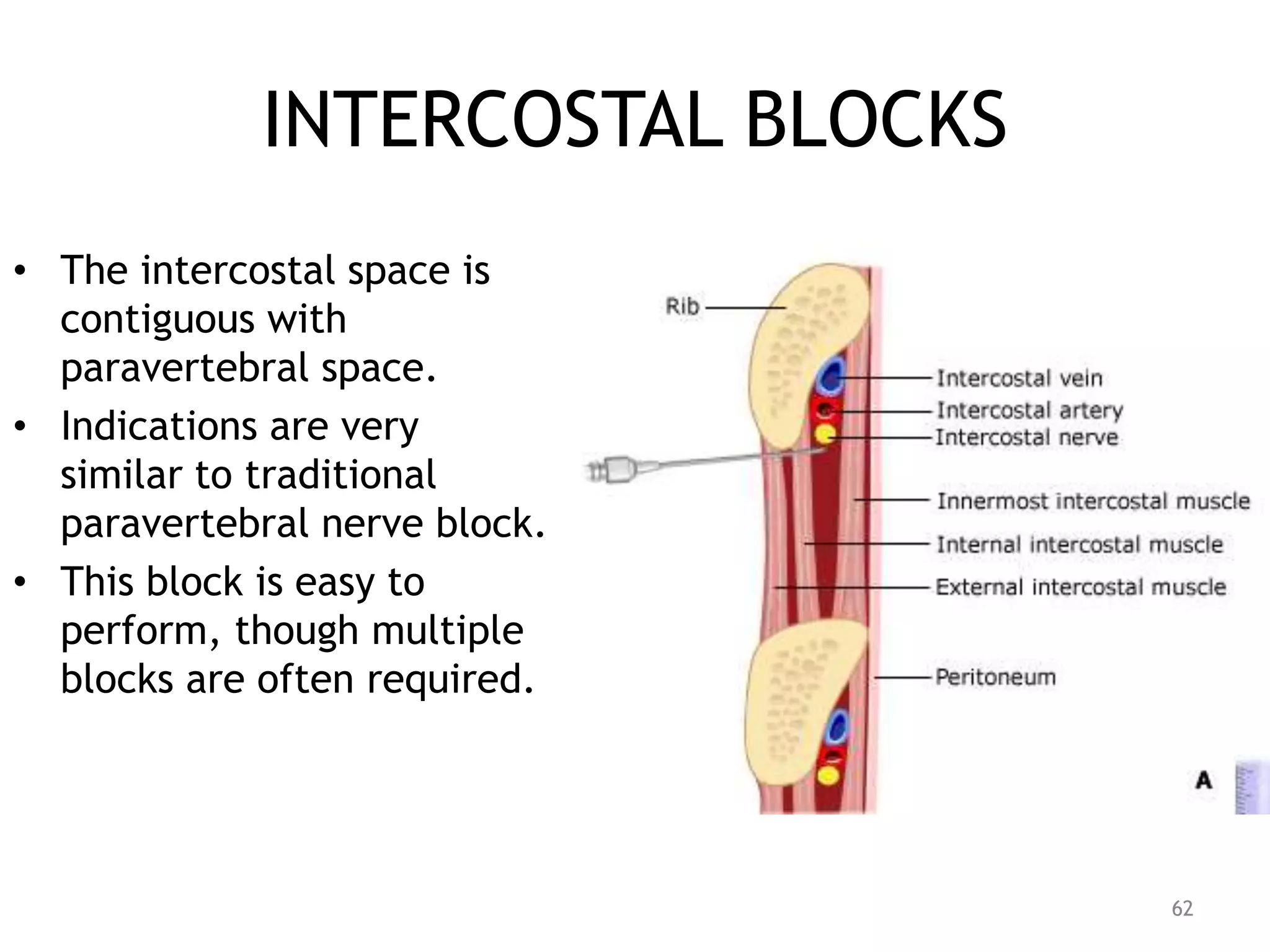 INTERCOSTAL BLOCKS
• The intercostal space is
contiguous with
paravertebral space.
• Indications are very
similar to traditional
paravertebral nerve block.
• This block is easy to
perform, though multiple
blocks are often required.
62
 