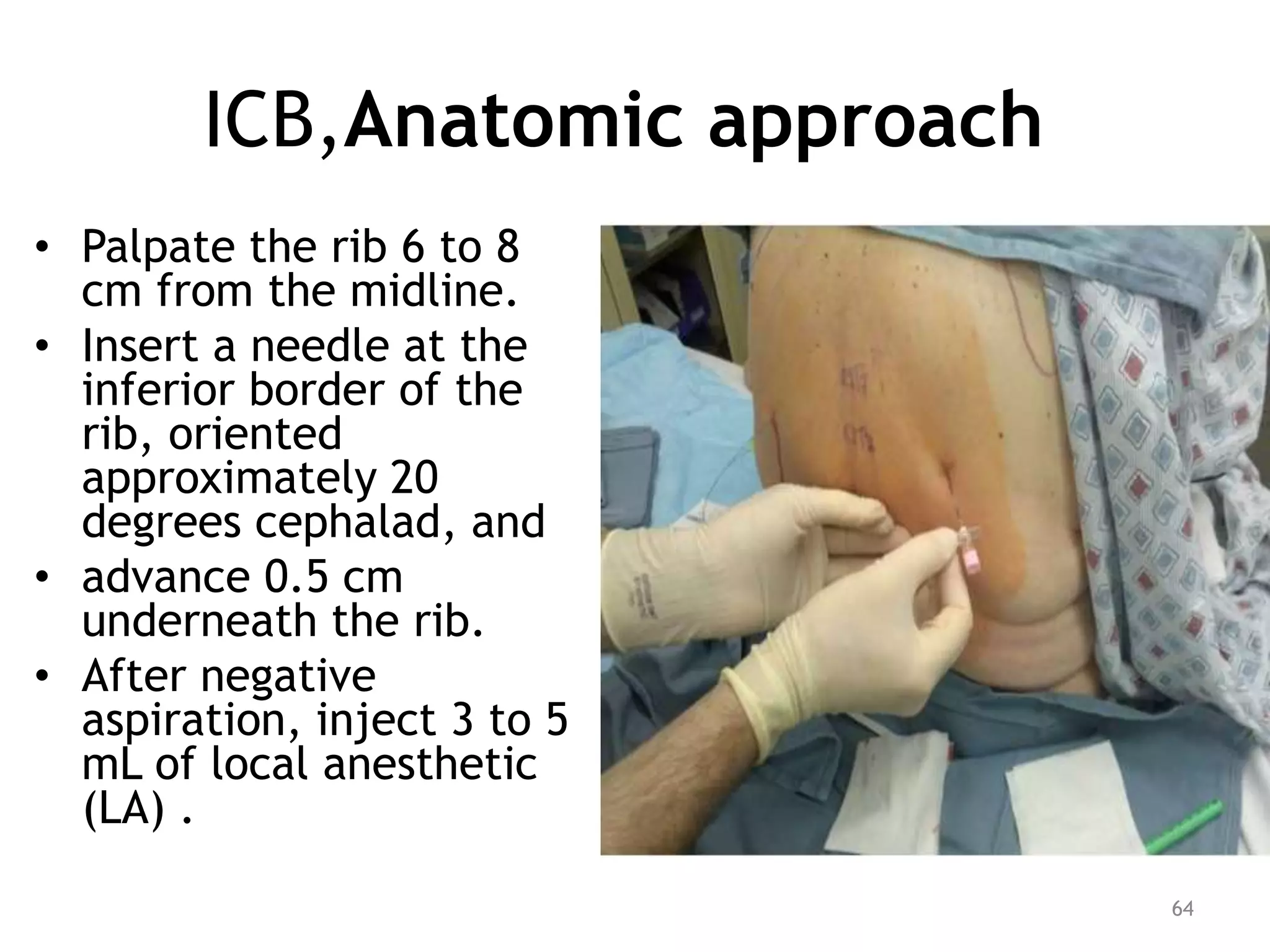 ICB,Anatomic approach
• Palpate the rib 6 to 8
cm from the midline.
• Insert a needle at the
inferior border of the
rib, oriented
approximately 20
degrees cephalad, and
• advance 0.5 cm
underneath the rib.
• After negative
aspiration, inject 3 to 5
mL of local anesthetic
(LA) .
64
 