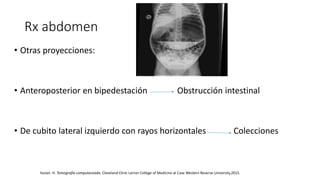 Rx abdomen
• Otras proyecciones:
• Anteroposterior en bipedestación Obstrucción intestinal
• De cubito lateral izquierdo con rayos horizontales Colecciones
Ilaslan H. Tomografía computarizada. Cleveland Clinic Lerner College of Medicine at Case Western Reserve University.2015.
 