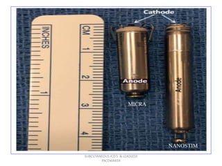 SUBCUTANEOUS ICD'S & LEADLESS
PACEMAKER
MICRA
NANOSTIM
 