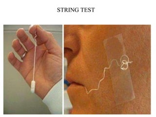 samplecollection and transport of sample | PPTX