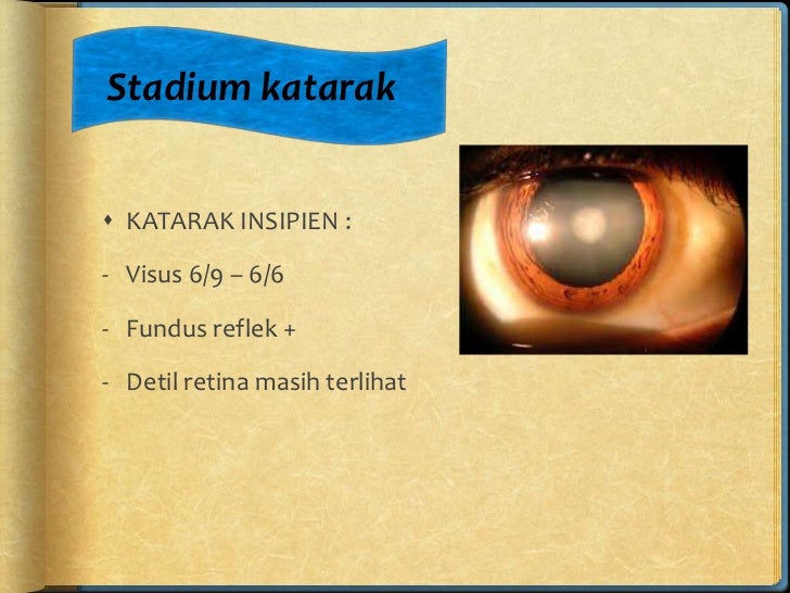 Skrinning & Penatalaksanaan Paska Operasi Katarak