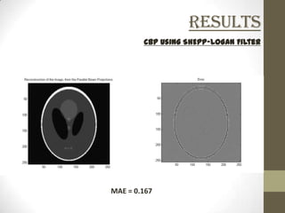 Results
        CBP using SHEPP-LOGAN Filter




MAE = 0.167
 