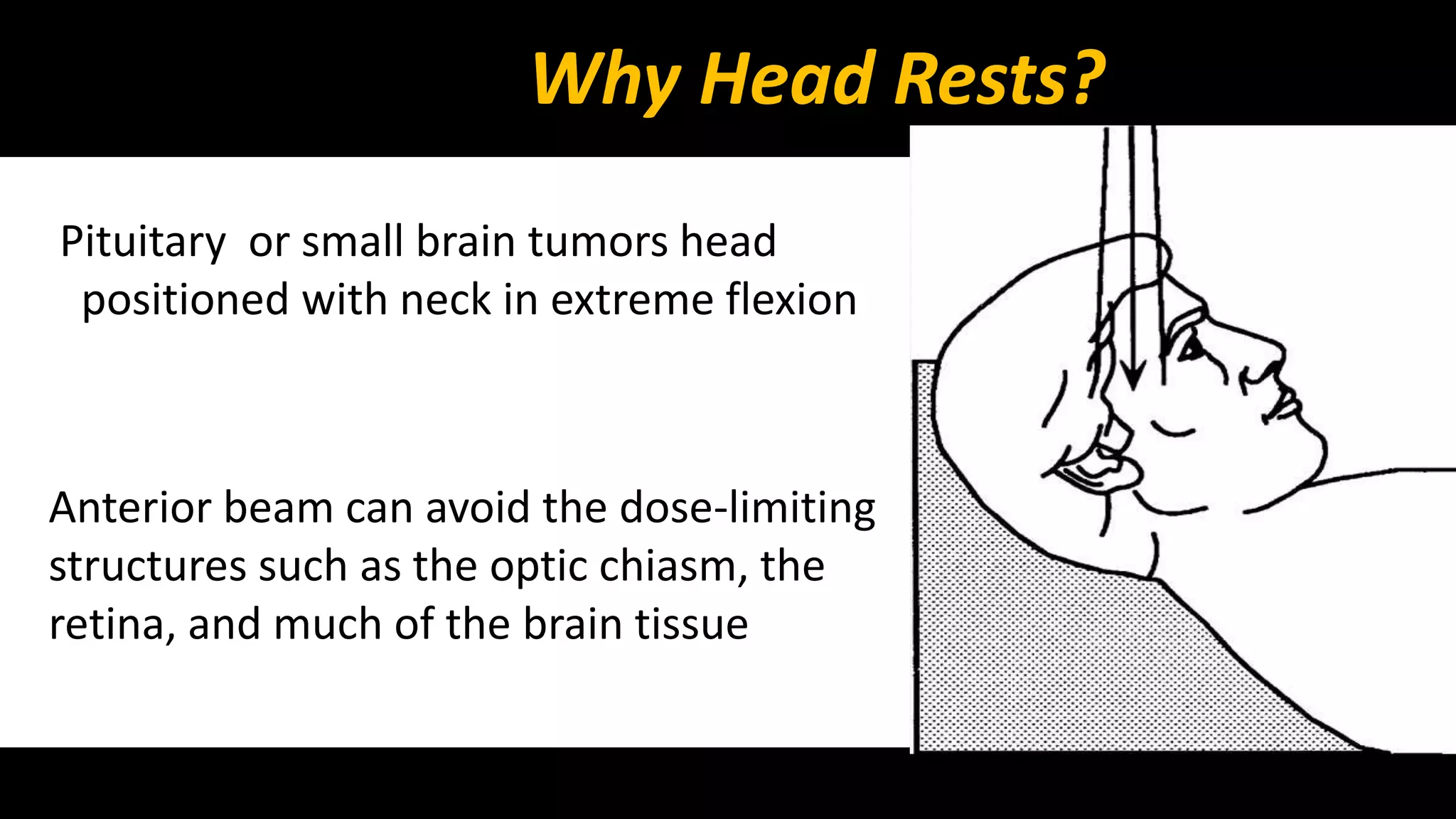 Why Head Rests? 
Pituitary or small brain tumors head 
positioned with neck in extreme flexion 
Anterior beam can avoid the dose-limiting 
structures such as the optic chiasm, the 
retina, and much of the brain tissue 
 